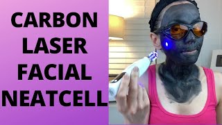 Carbon Laser Facial using Neatcell Picosecond Pen  At Home Carbon Facial  At Home Picosend Laser [upl. by Oirazan]