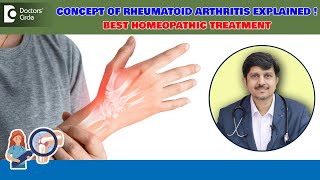 Rheumatoid Arthritis RA Factor controlled by Homeopathy Dr Sanjay Panicker  Doctors Circle [upl. by Rabiah]