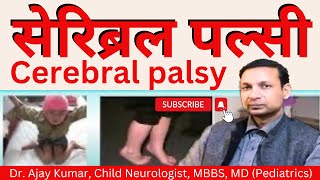 Cerebral Palsy  Dr Ajay Kumar Child Neurologist in Patna Call 7250023111 9546454005 [upl. by Arden721]