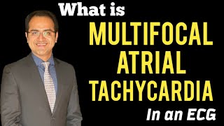 Wandering atrial pacemaker Multifocal Atrial Tachycardia MAT ECG Lectures Treatment USMLE [upl. by Auvil]