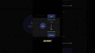 AVNRT ECG Electrical impulse [upl. by Nagem]