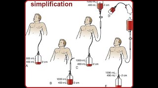 What is Autotransfusion units Working principle Autotransfusion Advantages ampDisadvantages [upl. by Letsou]