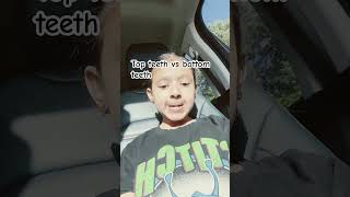 Top teeth vs bottom teeth rapper [upl. by Attalie809]