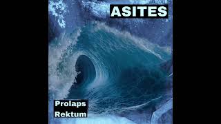 Asites  Prolaps Rektum 2024 [upl. by Anilave]