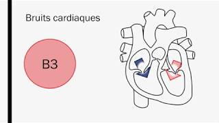 Lauscultation cardiaque  Baladodiffusion [upl. by Tima563]