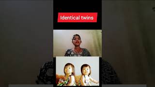 monochorionoc Diamniotic twins pregnancy kya hoti hai identical twins pregnancy dizygotic twins preg [upl. by Sholley]