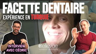 Implant Dentaire en Turquie et Facette dentaire  Soin et explication du processus [upl. by Nairehs]