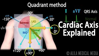 Cardiac Axis Interpretation Animation [upl. by Adnwahs]