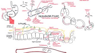 Microbiology  Helicobacter Pylori Ulcer [upl. by Alleul]