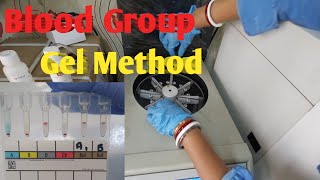 Blood Group Test By Gel Method  Forward Blood Grouping Gel Technology [upl. by Jessamine]