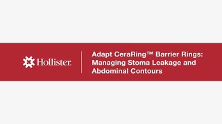 Hollister Adapt CeraRing™ Flat Barrier Rings Managing Stoma Leakage and Abdominal Contours [upl. by Earised925]