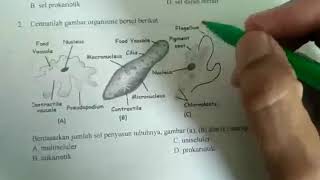 Protozoa berdasarkan alat gerak Rhizopoda Ciliata Flagellata Sporozoa Protista mirip hewan [upl. by Rob926]