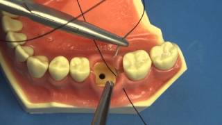 Surgical Technique  Figure of Eight Close Vertical Dental amp Medical Suturing by Stuart OrtonJones [upl. by Chiou549]