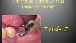 Técnica de cubeta cerrada y transfer Z [upl. by Rabbaj]