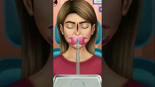 Broken nose surgery  mengoperasi hidung [upl. by Wilda929]