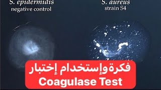 فكرة واستخدام اختبار Coagulase Test [upl. by Sudaorb]