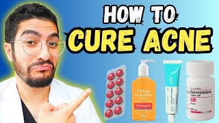 99 Overlook These Effective Acne Treatments – 2024 Guide [upl. by Isaacs417]