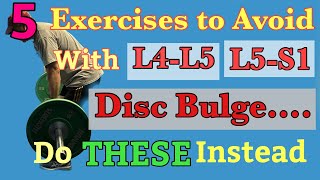 5 WORST Exercises with L4L5 and L5S1 Disc Bulge REPLACE WITH THESE Dr Frank Altenrath Cresskill [upl. by Nagrom632]