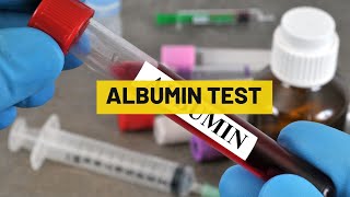 Albumin Test  My Lab Solution [upl. by Annairoc941]