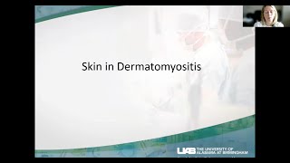 Myositis and the Skin [upl. by Bel416]