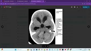 RADIOLOGY EXAM CASES [upl. by Femi]