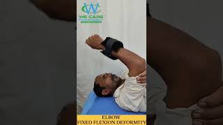 ELBOW FFDFIXED FLEXION DEFORMITY india b vs india a backpain goat box office collection [upl. by Benito736]