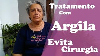 TRATAMENTO COM ARGILA EVITA CIRURGIA DE CATARATA Depoimento [upl. by Londoner273]