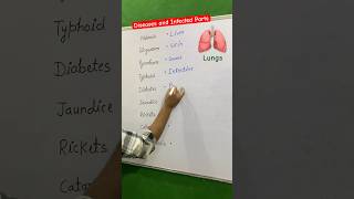 👉 Diseases and Infected Parts 🫁  disease malaria typhoid biology gk shorts ytshorts [upl. by Whelan232]