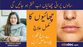 GET RID OF PIGMENTATION  Chaiyan Khatam Karne Ka Tarika  Melasma Aur Pigmentation Ka Ilaj [upl. by Pfeffer33]