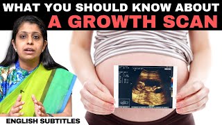 Growth Scan In Pregnancy  கரு வளர்ச்சி ஸ்கேன் பற்றி நீங்கள் தெரிந்து கொள்ள வேண்டிய விஷயங்கள் [upl. by Aikrahs]