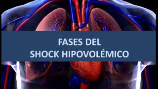 Fases del shock hipovolémico [upl. by Annerol]