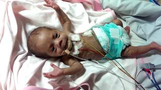 How a preemie baby started crying when she was Hungry [upl. by Ahsienet]