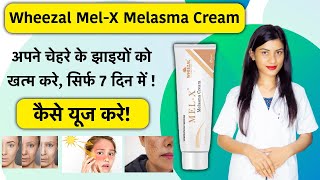 Wheezal MelX Cream Uses in Hindi  Wheezal MelX Cream Review  Mel X Cream  Mel X Melasma Cream [upl. by Plotkin]