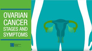 Understanding Ovarian Cancer Stages and Symptoms [upl. by Aytnahs548]