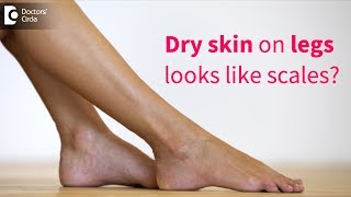 Great tips to get rid of very dry flaky skin on legs  Dr Rasya Dixit  Doctors Circle [upl. by Karlan46]