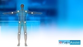 Fibromyalgia Explained Learn About 11 Tender Points Symptoms Causes of Fibromyalgia [upl. by Eanel447]