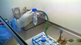 10 Demonstration of processing of sputum specimen for culture for diagnosis of tuberculosis [upl. by Annez]