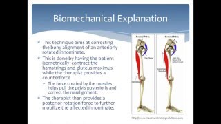 Mobilization to correct an Anterior Innominate rotation of the pelvis Physical Therapy [upl. by Barmen]