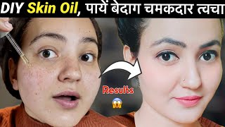 Homemade FACE  SKIN OIL Serum  Get Rid of Acne Pimples Fine Lines Glowing Spotless Skin💕 [upl. by Novyak51]