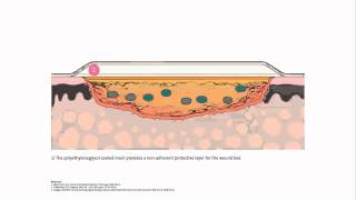 INADINE™ Povidone Iodine NonAdherent Dressing  Mode of action [upl. by Leonteen476]