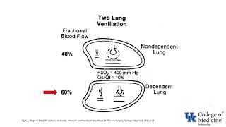 Respiratory Physiology Ventilation Perfusion Ratios  Dr Bowe [upl. by Dearr389]