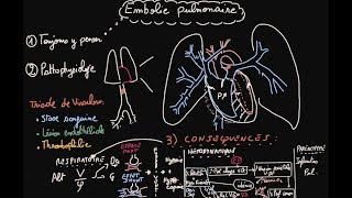 Embolie pulmonaire  Pathophysiologie  Partie 1  Docteur Synapse [upl. by Feune98]