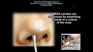 MRSA ScreeningTests Ortho Surgeons Think About  Everything You Need To Know  Dr Nabil Ebraheim [upl. by Adiol]