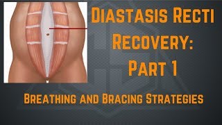 Diastasis Recti Recovery Part 1 Breathing and Bracing Strategies [upl. by Hyatt]