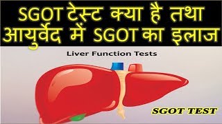 SGOT Test in hindi – क्यों और किस कारण बढ़ता है SGOT – sgot kya hai [upl. by Nonnairb]