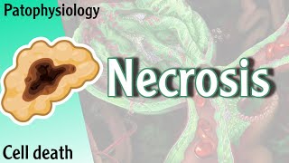 Pathophysiology  Necrosis cell death Hani Laith شرح [upl. by Afton]