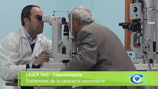 Traitement de la cataracte secondaire par le laser Capsulotomie YAG [upl. by Anirhtak]