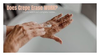 Crepe erase reviews  crepe erase treatment  Crepey skin Erase Reviews 2020  remove Crepey Skin [upl. by Ahsyekat337]