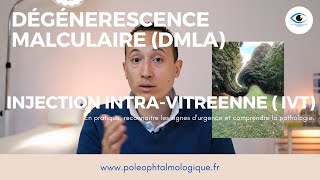 Dégénérescence maculaire liée à lâge DMLA et injection intravitréene IVT Pole Ophtalmologique [upl. by Yrtneg848]