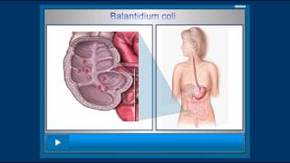 Balantidium Coli [upl. by Nakhsa]